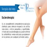 Aprovecha los beneficios de la escleroterapia