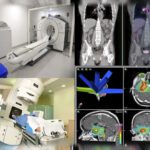 Aprovechando los beneficios de la energía nuclear en la medicina