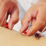 Experimenta los beneficios de la electroacupuntura