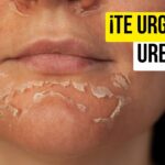 Los increíbles beneficios de la crema de urea