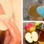 Los sorprendentes beneficios del vinagre de manzana en tu piel
