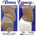 Maximiza tus beneficios con Venus Legacy