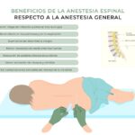 Beneficios de la anestesia