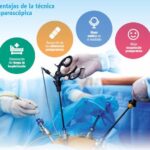 Beneficios de la cirugía laparoscópica