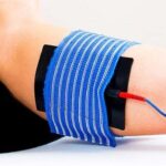 Beneficios de la iontoforesis