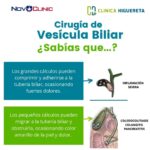 Beneficios de la operación de vesícula