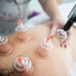 Beneficios de las ventosas en la espalda
