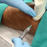 Beneficios en la recuperación de una infiltración en la rodilla