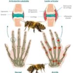 Beneficios increíbles de la apitoxina