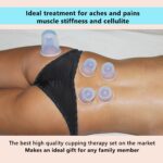 Cupping Therapy: Tu aliado para una salud óptima