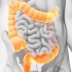 Desintoxica tu colon y mejora tu salud