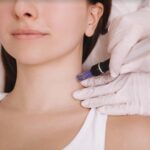 Deslumbra con la piel que siempre quisiste: beneficios del dermapen