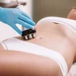 El poder de la cavitación: ventajas para tu cuerpo