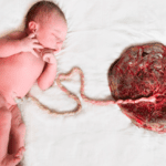 Placenta Bebé: Conoce sus Beneficios