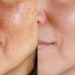 Potencia los beneficios de la piel con agua oxigenada