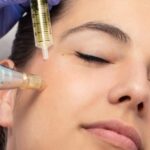 Potencia tu belleza con inyecciones de plasma en el rostro