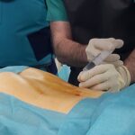 Potencia tu salud con la terapia de ozono