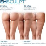 Potencia tus resultados con Emsculpt