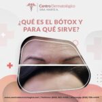 Potenciando tu belleza: beneficios del botox