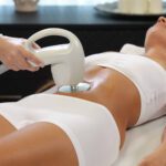 Radiante abdomen: descubre los beneficios de la radiofrecuencia