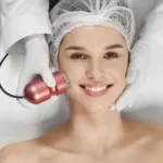 Radiante con radiofrecuencia facial