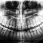Radiografía de beneficios: ¡Explora las Beneficios de cada día!