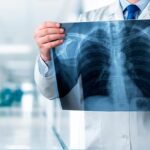 Rayos X: ¿Qué beneficios ofrecen?