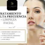Recopilando ventajas: Beneficios de la alta frecuencia