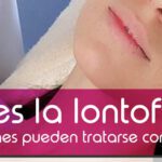 Rostro radiante: todos los beneficios de la iontoforesis