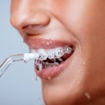 Sonríe sin preocupaciones con un irrigador dental