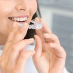 Sonrisas perfectas: beneficios de la ortodoncia invisible